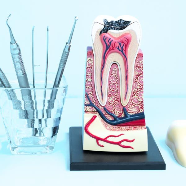 Model of tooth next to dental tools