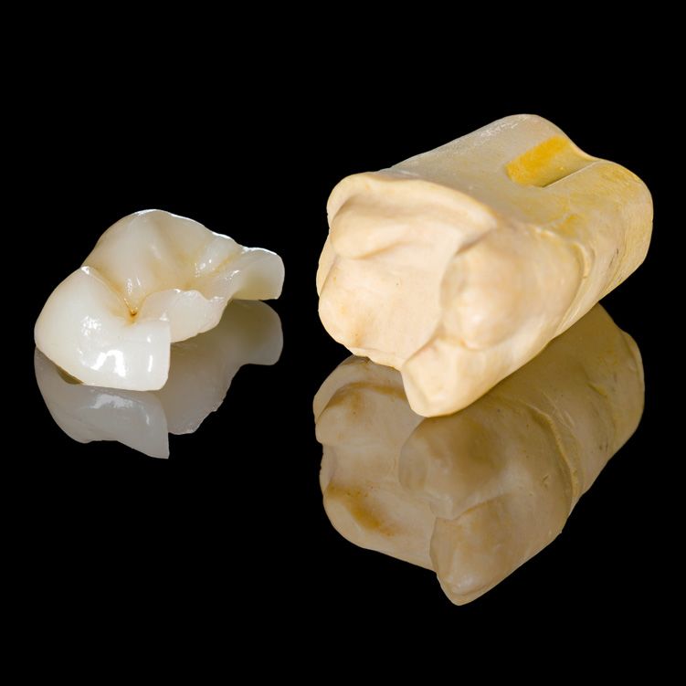 Dental crown